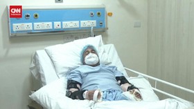 VIDEO: Pria India Sukses Jalani Transplantasi Tangan Ganda Pertama