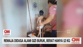 VIDEO: Remaja Diduga Alami Gizi Buruk, Berat Hanya 12 Kg