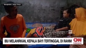 VIDEO: Ibu Melahirkan, Kepala Bayi Tertinggal di Rahim
