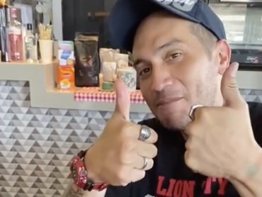 Kata Polisi soal Kronologi Kecelakaan Gary Iskak, Motor Tabrak Pohon-Terpelanting