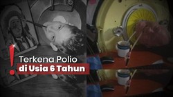 img-title Paul Alexander Meninggal Dunia Usai 72 Tahun Ditopang Paru-paru Besi