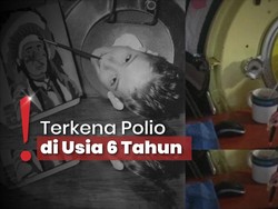 Paul Alexander Meninggal Dunia Usai 72 Tahun Ditopang Paru-paru Besi