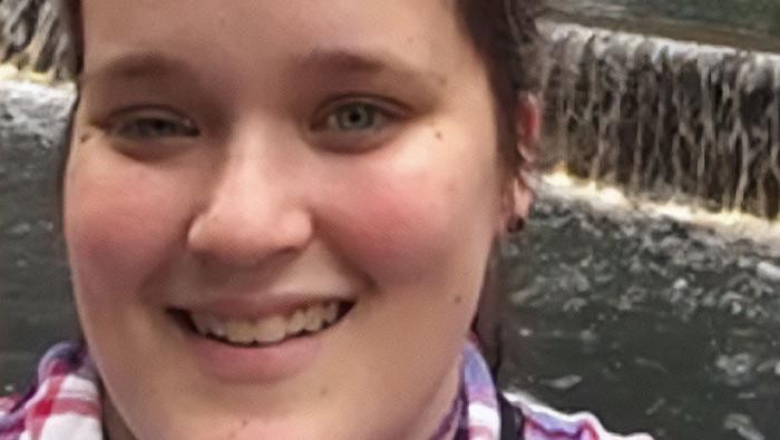 Gegara Selfie, Perempuan Ini Ketahuan Punya Tumor Otak! Ini Kisahnya