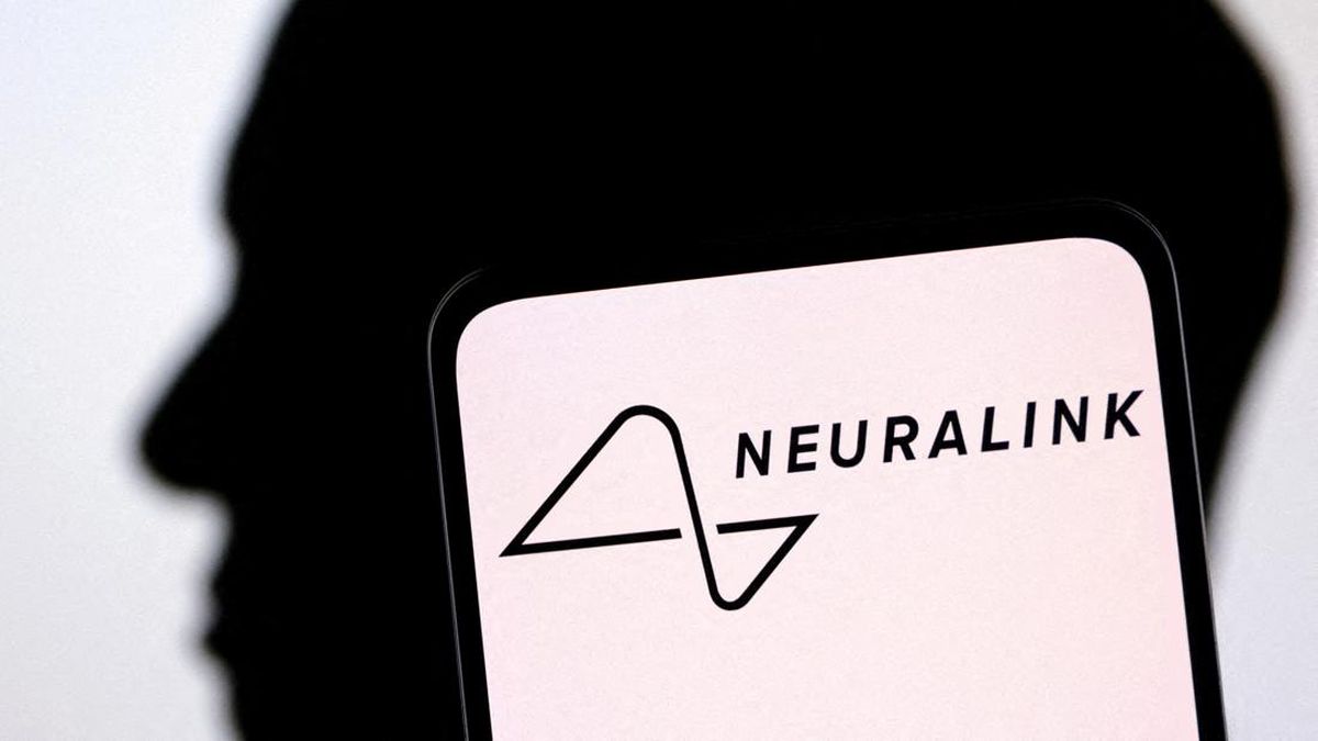 12 Orang Sudah Implan Chip Otak Punya Elon Musk, Begini Dampaknya