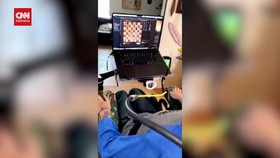 VIDEO: Cerita Pasien Pertama Neuralink Gerakkan Catur Pakai Pikiran
