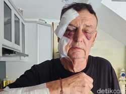 Imigrasi Bali Ungkap Alasan Pendeportasian Bule Australia yang Dianiaya