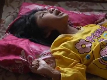 Kisah Anak Tukang Tahu, Merintih karena Luka Bakar Tersiram Minyak