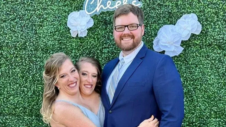 Abby dan Brittany Hensel