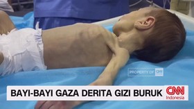 VIDEO: Bayi-Bayi Gaza Derita Gizi Buruk