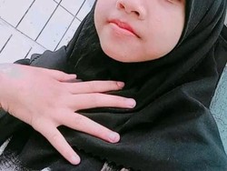 Pamit Beli Es Krim, Gadis Asal Cikancung Bandung Dilaporkan Hilang