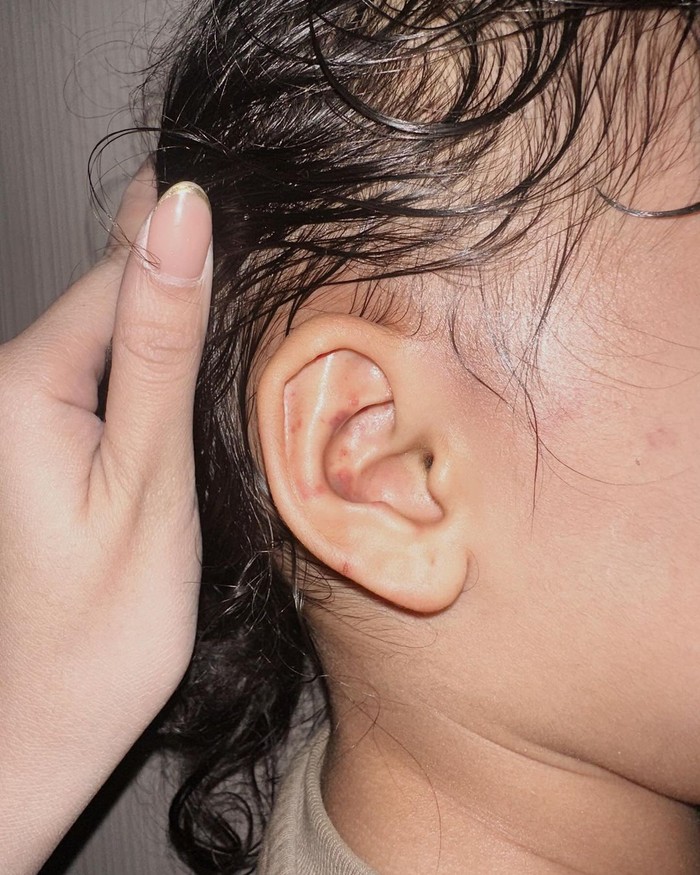 4 Fakta Penganiayaan Anak Aghnia Punjabi oleh Pengasuhnya