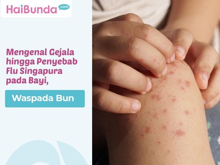 Mengenal Gejala hingga Penyebab Flu Singapura pada Bayi, Waspada Bun