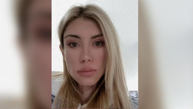 Runner-up Mrs Russia International 2022 Yulia Tarasevich tak bisa menutup matanya atau tersenyum akibat prosedur operasi plastik yang gagal.