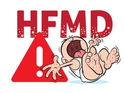 Banyak Dialami Anak Usia 5 Tahun, Ini Gejala Flu Singapura yang Harus Diwaspadai