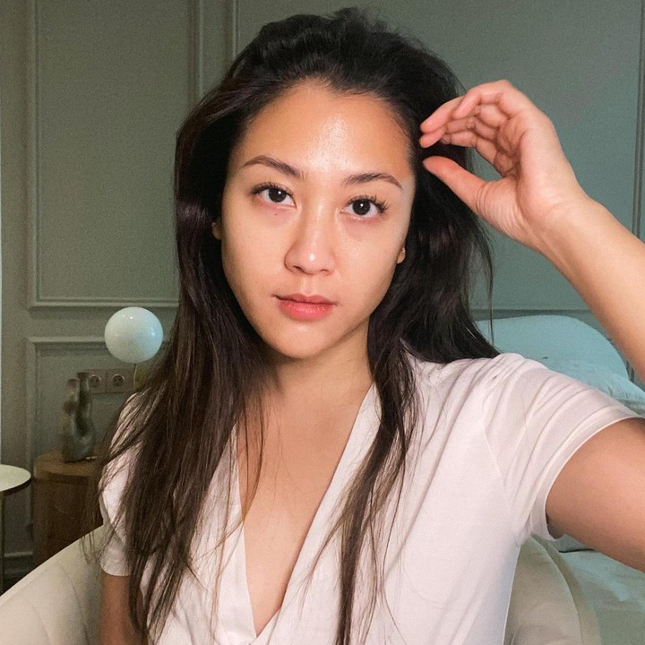 <p>Sherina Munaf membagikan kabar mengenai kondisi kesehatannya. Ia sedang menjalani terapi untuk mengatasi kelainan tulang belakangnya, Bunda. (Foto: Instagram @sherinamunaf)</p>