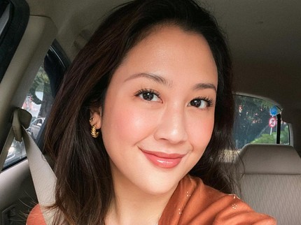 7 Potret Terbaru Sherina, Ungkap Kondisi Skoliosis dan Harus Banyak Istirahat