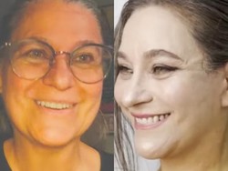 Penampilan Pangling Nenek 57 Tahun usai Menang Undian Oplas Gratis