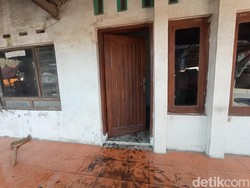 Pilu Istri Sekujur Tubuh Dibakar Suami Sendiri di Cirebon