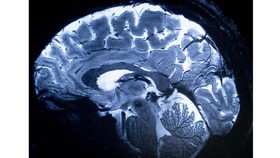 Foto Detail Pertama Otak Manusia Dilihat dari MRI Tercanggih di Dunia