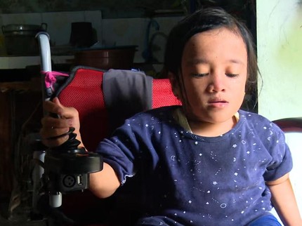 Hadapi Penyakit Tulang Kaca, Anak Guru Honorer Punya Mimpi Jadi Dokter