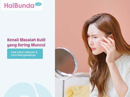 Kenali Masalah Kulit yang Sering Muncul Usai Libur Lebaran & Cara Mengatasinya
