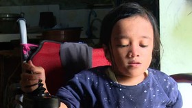 Donasi untuk Rahma Penderita Penyakit Tulang Langka lewat Berbuatbaik