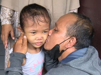 Anak Kurir Berjuang Hadapi Penyakit Langka dengan Tubuh Tak Sempurna