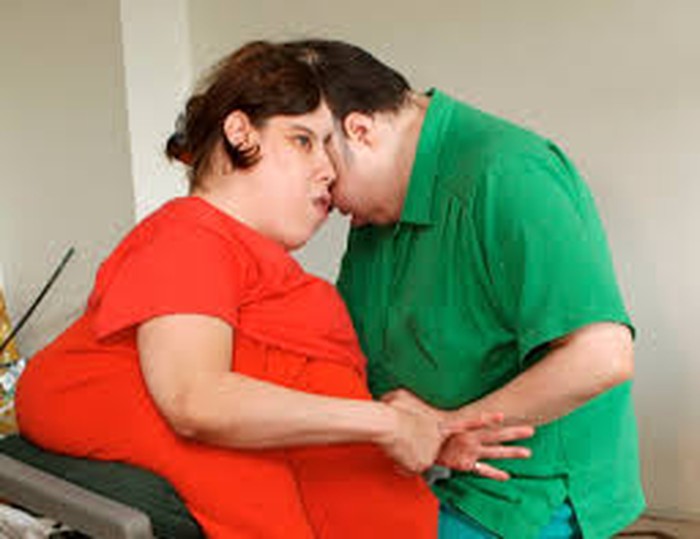 Kembar siam tertua di dunia