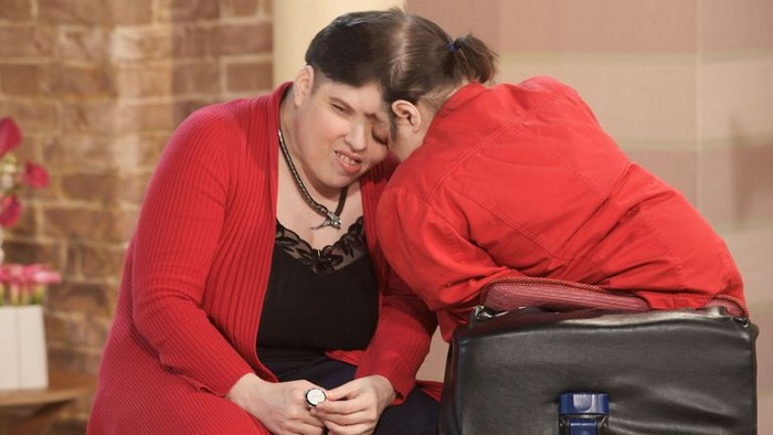 Kembar siam tertua di dunia