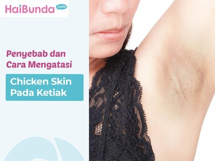 Penyebab dan Cara Mengatasi Chicken Skin Pada Ketiak