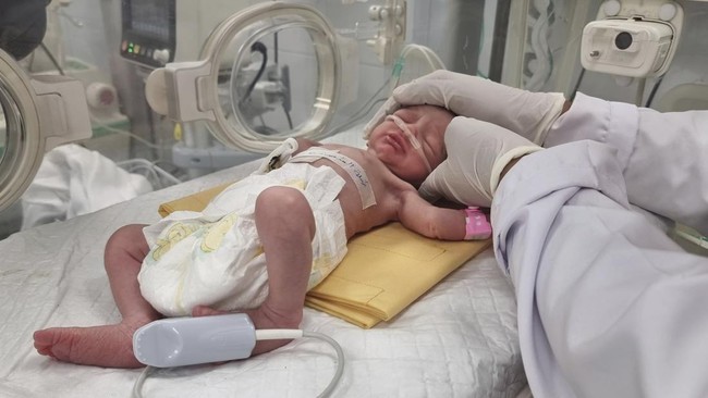 Seorang bayi di Gaza, Palestina yang belum lama ini lahir dari ibu yang tewas dibunuh tentara Israel kini meninggal dunia.