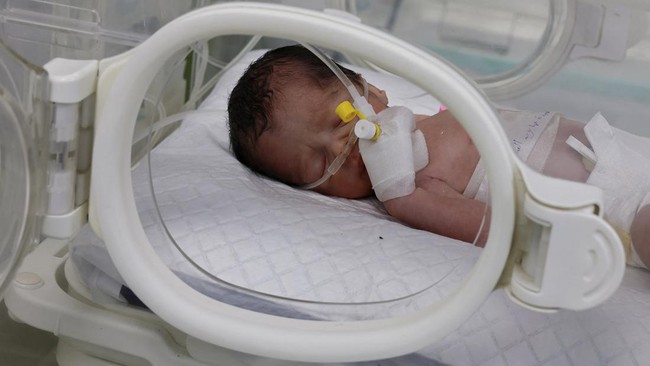 FOTO: Bayi di Gaza Diselamatkan dari Rahim Ibunya yang Dibunuh Israel