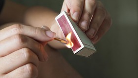 Bocah 10 Tahun Kritis usai Diduga Dibakar 4 Orang Teman di Situbondo