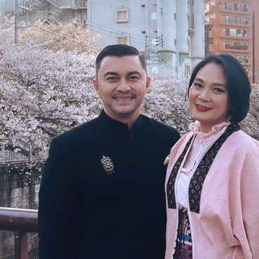 Respons Anjasmara Usai Dian Nitami Lakukan Oplas di Korea