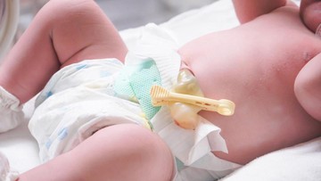 CARA MERAWAT TALI PUSAR BAYI