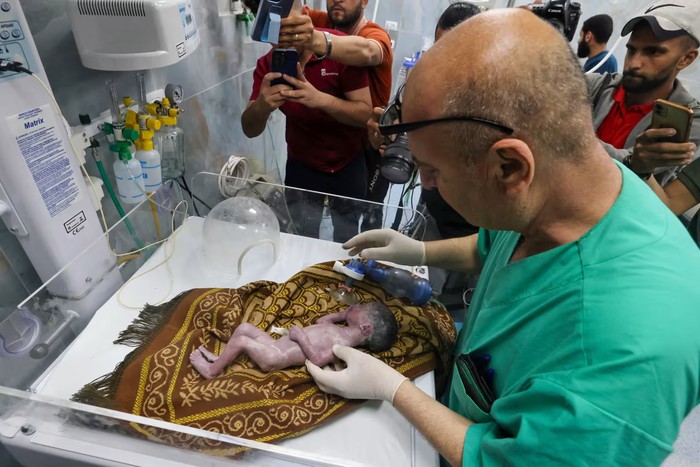 Bayi korban perang di Gaza