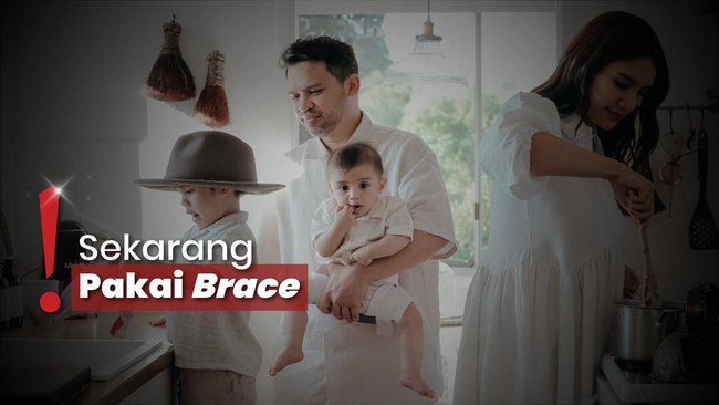 Acha Sinaga Cerita Anak Idap Hip Dysplasia: Tuhan Kenapa Kita?