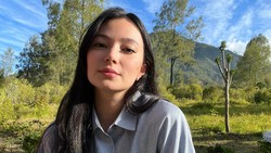 Kondisi Terkini Asmirandah usai Jatuh di Kamar Mandi, Kaki Robek Dapat 8 Jahitan