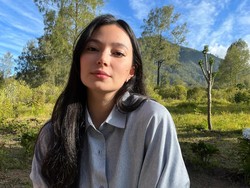 Kondisi Terkini Asmirandah usai Jatuh di Kamar Mandi, Kaki Robek Dapat 8 Jahitan