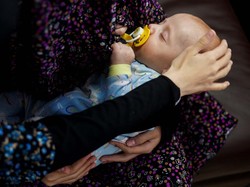 Derita Bayi-bayi di Gaza Tak Kunjung Usai, Kini Terancam kena Meningitis
