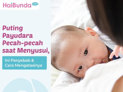 Puting Payudara Pecah-pecah saat Menyusui, Ini Penyebab & Cara Mengatasinya