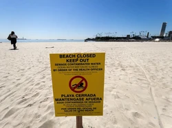 Jorok! Pantai di Inggris Banyak Dipenuhi Kotoran Manusia