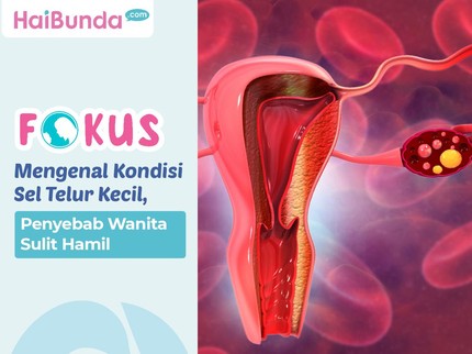 Mengenal Kondisi Sel Telur Kecil, Penyebab Wanita Sulit Hamil