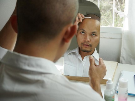 Rambut Botak Depan Tanda Alami Gangguan Kesuburan, Simak Faktanya!