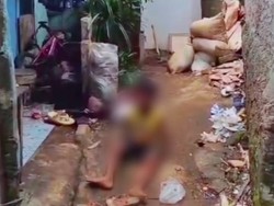 Dinsos Jelaskan Kondisi Terkini Bocah Nangis Lapar Malah Disiram Ibu di Bogor
