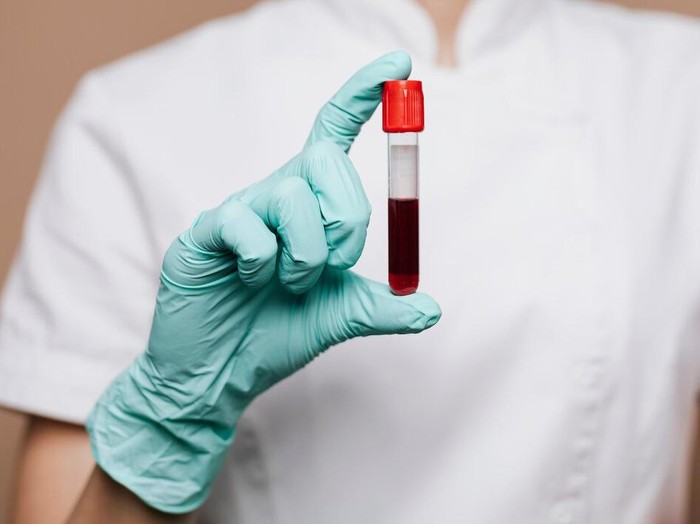 Ilustrasi tes darah/Foto: Freepik.com/rawpixel.com