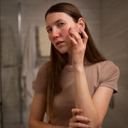 5 Penyebab Wajah Terlihat Bengkak Setelah Bangun Tidur dan Cara Mengatasinya