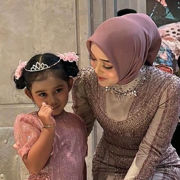 Orang Tua Asuh Bintang Bongkar Sikap Keluarga Sule Saat Ketemu di Nikahan Iky