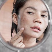 5 Kebiasaan Pemicu Flek Hitam yang Kerap Tak Disadari, Kamu Suka Lakukan Nggak Nih?