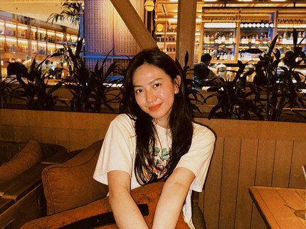 Pengalaman Shanju Eks JKT48 USG Fetomaternal, Kaget Jenis Kelamin Baby Berubah